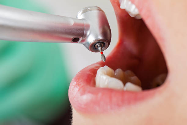 Best Urgent Care for Lost Fillings or Crowns in Newberry, FL